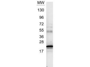 IL-6 antibody 25 μl