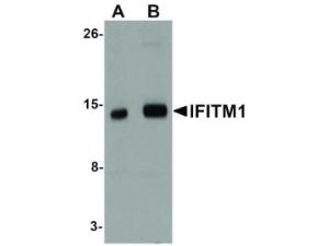 IFITM1 (rabbit) antibody 100 µg
