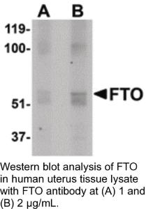 Anti-FTO Rabbit Polyclonal Antibody