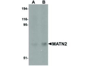 MATN2 antibody 100 µg