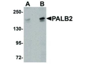 PALB2 antibody 100 µg