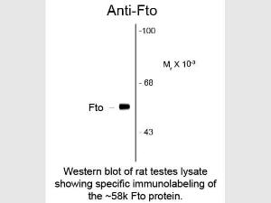 FTO antibody 100 μl