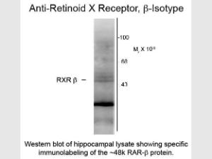 Retinoid X receptor beta antiB