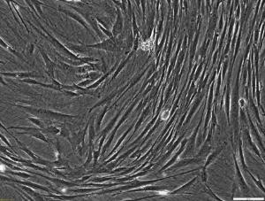 CELLvo™ Human Bone Marrow-Mesenchymal Stem Cells (hBM-MSC), StemBioSys, Inc. (SBS)