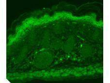 TRPV3 antibody 100 μg