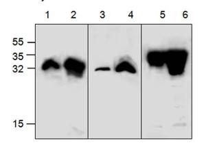 Western-Blot-Analyse von GFP-Antikörper unter Verwendung von rekombinantem RFP (dsRed, Bahn 1 & 2), YFP (Bahn 3 & 4) und EGFP (Bahn 5 & 6).