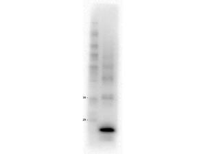 Procalcitonin 15F6.F6.F9 antibody 100 μg