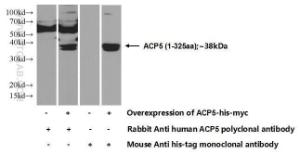 Anti-ACP5 Rabbit Polyclonal Antibody