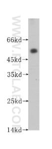 Anti-ACPP Mouse Monoclonal Antibody [clone: 1G2C9]