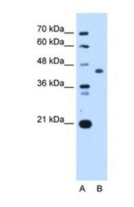 SSB Overexpression Lysate (Adult Normal), Novus Biologicals (NBL1-16464)