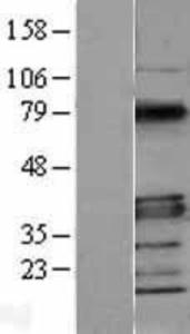 MyD88 Overexpression Lysate (Adult Normal), Novus Biologicals (NBL1-13419)