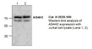Western blot analysis of DPPA4 expression using Jurkat cell lysate (Lane 1, 2).