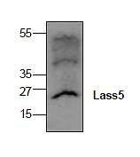 Western blot analysis of Lass5 expression in Jurkat cell lysate. Multiple isoforms of Lass5 can be detected.