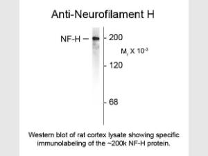 Neurofilament H antibody 100 μl