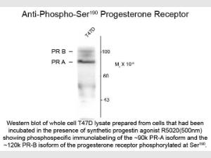 Progesterone receptor Phospho