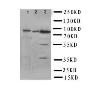 Anti-PI 3 Kinase p85 beta Rabbit Polyclonal Antibody