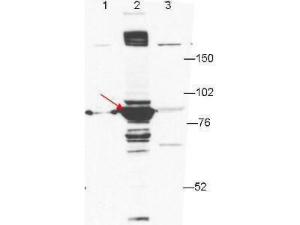 ESRP-1 antibody 25 μl