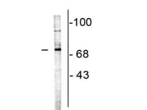 CHAT (Choline acetyltransferase)