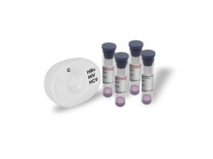 HBc/HIV/HCV antibody test controls