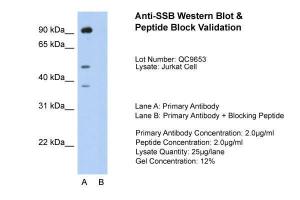 Antibody used in WB on Jurkat 2.0 µg/ml (Lane A: Primary Antibody and Lane B: Primary Antibody + Blocking Peptide ).