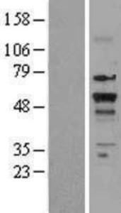 Thyroid Hormone Receptor beta Lysate (Adult Normal), Novus Biologicals (NBP2-11124)