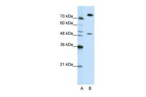 Antibody used in WB on Human Jurkat cells at 0.25 µg/ml.
