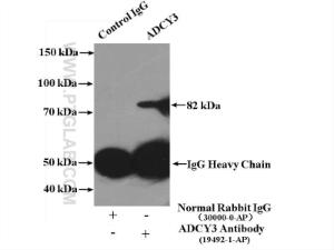 Anti-ADCY3 Rabbit Polyclonal Antibody