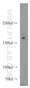 Anti-ADCY3 Rabbit Polyclonal Antibody