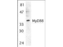 Antibody MYD88 (Rabbit) 100 μg