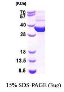 <i>E. coli</i> Recombinant Thioredoxin Reductase 1 (from <i>E. coli</i>)