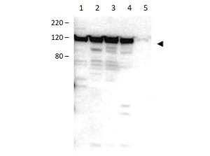 MYOSIN 1G antibody 1 μg 100 μg