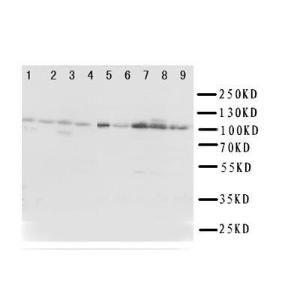Anti-TRPC3 Rabbit Polyclonal Antibody