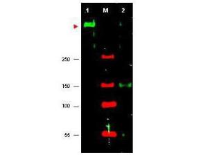ATR protein kinase [RBT] 1 μg