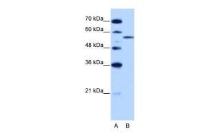 Antibody used in WB on Human HepG2 at 2.5 µg/ml.