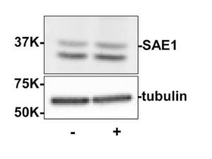 SAE1 antibody 100 μg