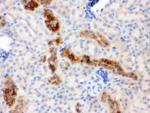 Anti-CALB1 Mouse Monoclonal Antibody [clone: CB-D7]