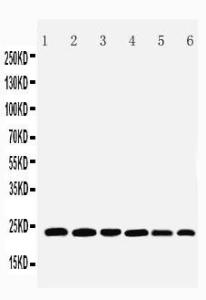 Anti-SNAP23 Rabbit Polyclonal Antibody