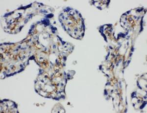 Anti-SNAP23 Rabbit Polyclonal Antibody