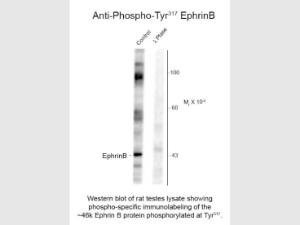 EPHRINB Phospho T317 antibody
