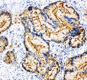 Anti-CEA Mouse Monoclonal Antibody [clone: CEA-9]