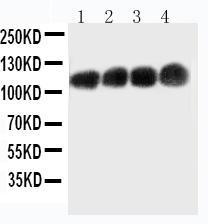 Anti-CEA Mouse Monoclonal Antibody [clone: CEA-9]