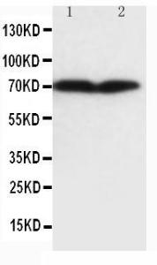 Anti-Collagen, Type III Mouse Monoclonal Antibody [clone: Col-29]