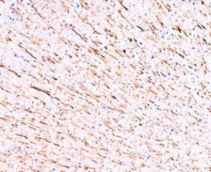 Anti-MAP1 Mouse Monoclonal Antibody [clone: MP-1]