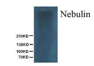 Anti-Nebulin Mouse Monoclonal Antibody [clone: Neb-20]