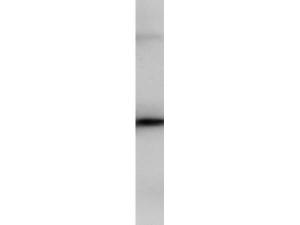 PIP5K2B antibody 100 μg