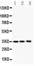 Anti-GMCSF1 Rabbit Polyclonal Antibody