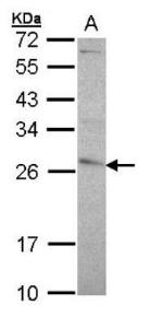 PDK4 Overexpression Lysate (Adult Normal), Novus Biologicals (NBL1-14252)