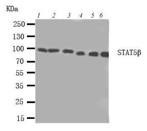 Anti-STAT5B Rabbit Polyclonal Antibody