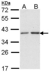 PRMT2 Overexpression Lysate (Adult Normal), Novus Biologicals (NBL1-14793)