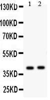 Anti-NDRG2 Rabbit Polyclonal Antibody